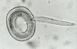 roundworm-larvae